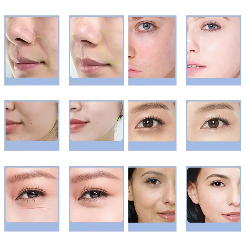 7 Types Facial CO2 Oxygen Bubb - Aha Bha Exfoliant 评论和价格