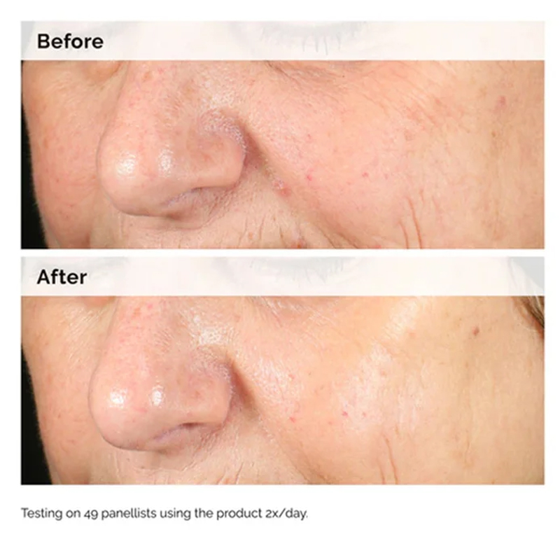Alpha Arbutin 2% + HA 30ml Ser - Aha Bha Exfoliant 评论和价格