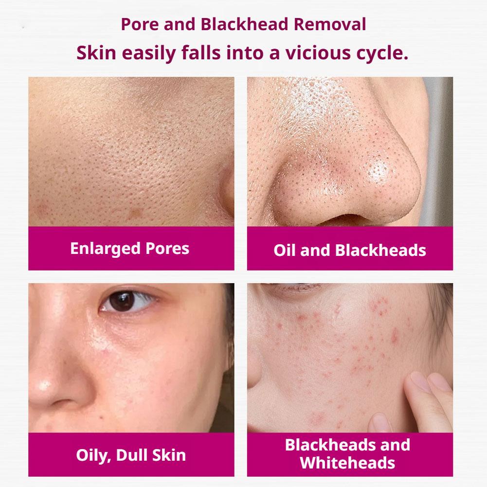 Salicylic Acid Shrink Pores Se - Aha Bha Exfoliant 评论和价格