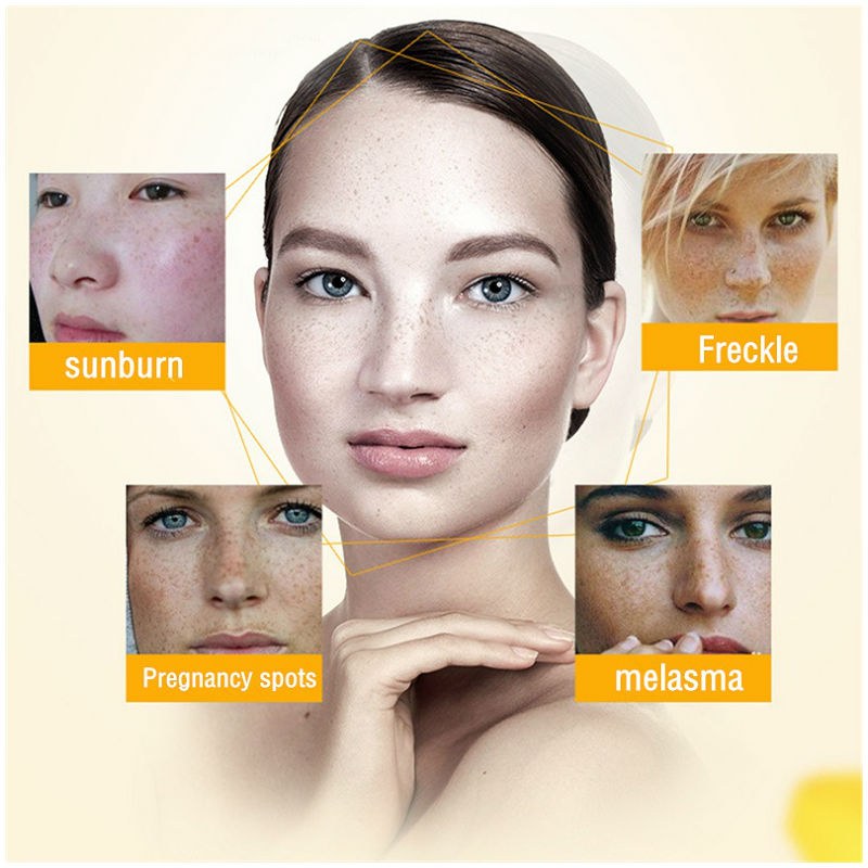 Dimollaure Whitening Freckle C - Skincare Herbal 评论和价格