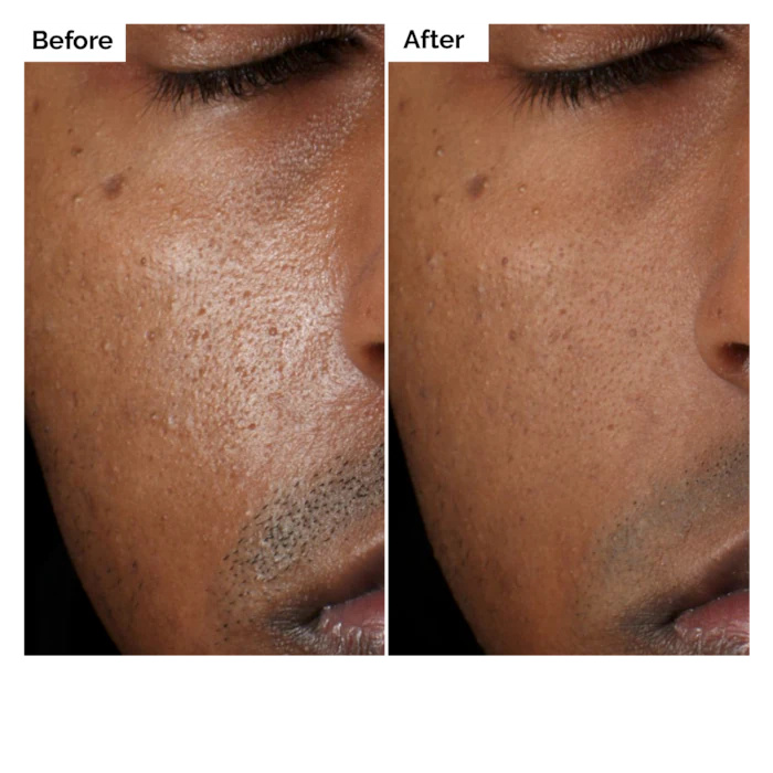 Aloe 2% + NAG 2% Solution Seru - Aha Bha Exfoliant 评论和价格