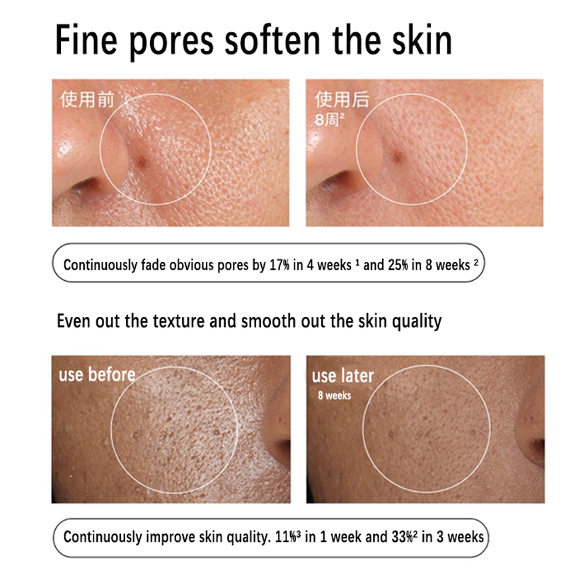 Aloe 2% + NAG 2% Solution Seru - Aha Bha Exfoliant 评论和价格